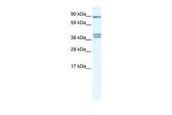 CLCNKB Rabbit anti-Human, Polyclonal, Novus Biologicals:Antibodies:Primary